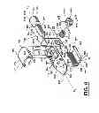 Fig. 04 - Adjustable spine distraction implant