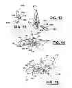 Fig. 06 - Adjustable spine distraction implant