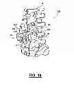 Fig. 07 - Adjustable spine distraction implant