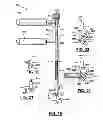 Fig. 10 - Adjustable spine distraction implant
