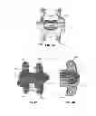 Fig. 19 - Adjustable spine distraction implant