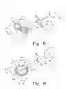 Fig. 07 - Radially expandable spinal interbody device and implantation tool