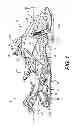 Fig. 02 - Method of controlling a hydraulic continuously variable transmission