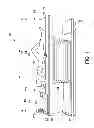 Fig. 02 - Medical image table assembly and method of manufacturing the same