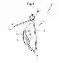 Fig. 02 - Pushpin retaining device and method of retaining without object puncture