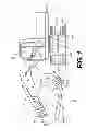 Fig. 02 - Meterless hydraulic system having multi-actuator circuit