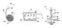 Fig. 01 - Platelet extraction from blood