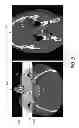 Fig. 06 - Systems and methods for viewing medical 3D imaging volumes