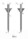 Fig. 06 - Pressure Wave Root Canal Cleaning System
