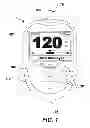 Fig. 02 - Hand-held test meter with phase-shift-based hematocrit measurement circuit