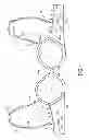 Fig. 02 - Brassiere Support System