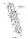 Fig. 72 - Golf clubs
