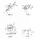Fig. 02 - Devices and methods for providing suction and/or irrigation in a surgical procedure