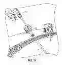 Fig. 09 - Devices and methods for providing suction and/or irrigation in a surgical procedure