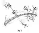 Fig. 02 - METHODS AND DEVICES FOR MANIPULATING TISSUE IN VIVO