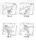 Fig. 03 - METHODS AND DEVICES FOR MANIPULATING TISSUE IN VIVO