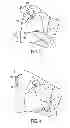 Fig. 04 - METHODS AND DEVICES FOR MANIPULATING TISSUE IN VIVO