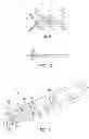 Fig. 06 - METHODS AND DEVICES FOR MANIPULATING TISSUE IN VIVO