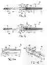Fig. 07 - METHODS AND DEVICES FOR MANIPULATING TISSUE IN VIVO