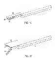 Fig. 09 - METHODS AND DEVICES FOR MANIPULATING TISSUE IN VIVO