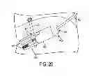 Fig. 11 - METHODS AND DEVICES FOR MANIPULATING TISSUE IN VIVO