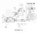 Fig. 20 - Patient-referenced surgical support frame