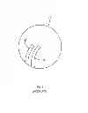 Fig. 02 - Optical fiber instrument system and method with motion-based adjustment