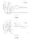 Fig. 04 - Evaluation of cardiac dyssynchrony based on chest wall motion and electrical cardiac activity