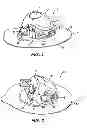 Fig. 02 - Insertion device for a medical conduit