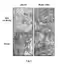 Fig. 04 - PLASMA-TREATED DIALYSIS CATHETER CUFF