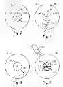 Fig. 04 - Systems and methods for disruption of an eye lens