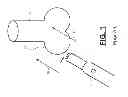 Fig. 02 - Surgical laser cutting device