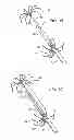 Fig. 09 - METHODS AND APPARATUS FOR FOCUSED BIPOLAR TISSUE ABLATION USING AN INSULATED SHAFT