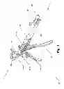 Fig. 02 - Surgical cable tensioning apparatus and method
