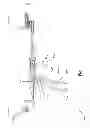 Fig. 58 - Surgical cable tensioning apparatus and method