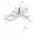Fig. 01 - Tissue-to-bone reattachment