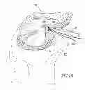 Fig. 02 - Tissue-to-bone reattachment