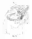 Fig. 04 - Tissue-to-bone reattachment