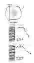 Fig. 04 - Apparatus and method for implanting and securing the position of implantable medical device