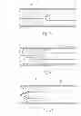 Fig. 07 - Atherectomy devices and methods