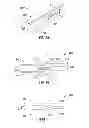 Fig. 03 - Surgical forceps