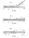 Fig. 09 - Surgical forceps