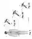 Fig. 02 - Device detachment systems with indicators