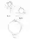 Fig. 02 - Braid-ball embolic devices