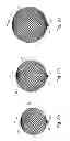 Fig. 03 - Braid-ball embolic devices