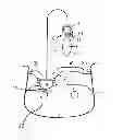 Fig. 01 - Femoral compression system