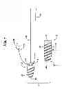 Fig. 02 - KNOTLESS SUTURE ANCHOR