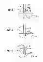 Fig. 03 - KNOTLESS SUTURE ANCHOR