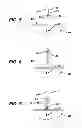 Fig. 04 - KNOTLESS SUTURE ANCHOR