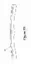 Fig. 08 - Spinal plate assembly